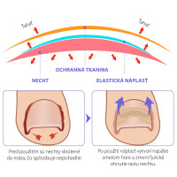 naplasti-nehty-6.jpg