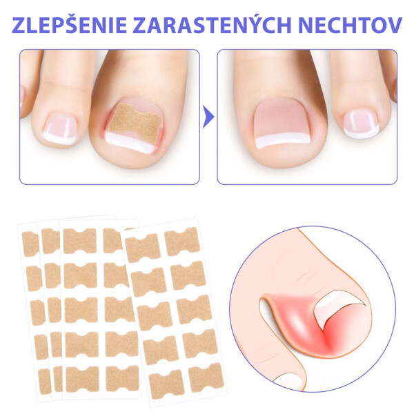 naplasti-nehty-3_2.jpg