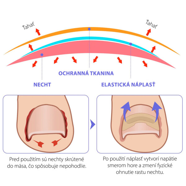 naplasti-nehty-6.jpg