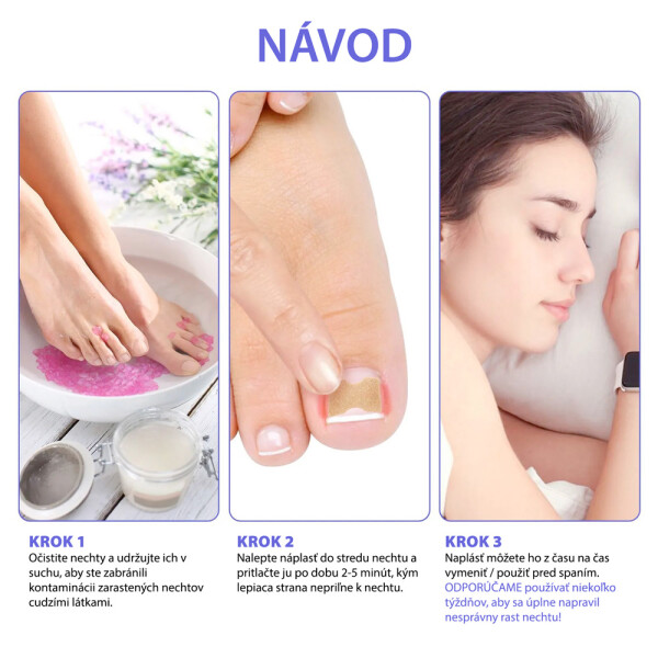 naplasti-nehty-navod_2.jpg