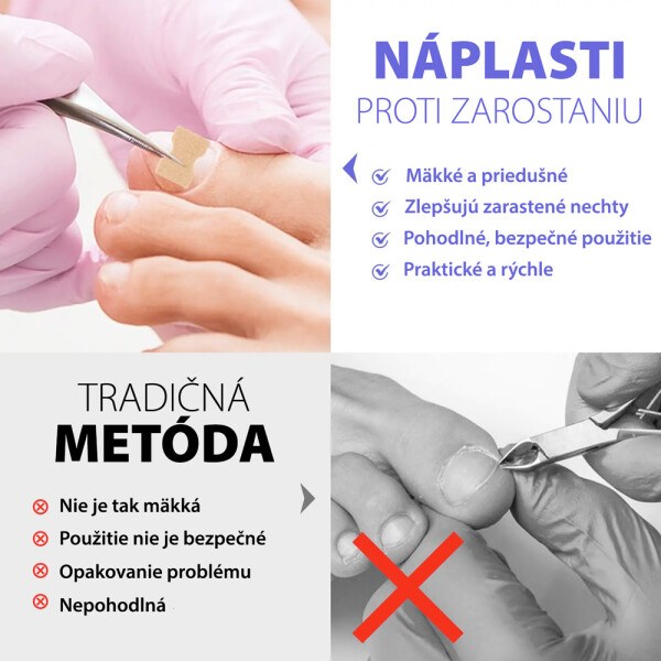 naplasti-trend_2.jpg